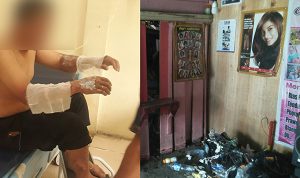 Ledakan Tabung Gas di Pasar Lama Parigi, Seorang Warga Alami Luka Bakar