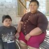 Bocah 12 Tahun Asal Desa Ramba Ini Miliki Berat Badan 150 Kg