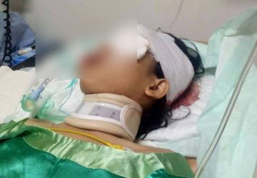 Dibegal, Mahasiswa di Bandung Luka Parah hingga Kritis