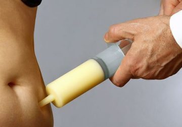 5 Efek Samping Sedot Lemak yang Perlu Anda Ketahui