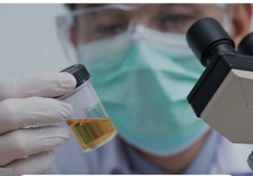Wow! ASN di Sulteng Ditantang Tes Urine
