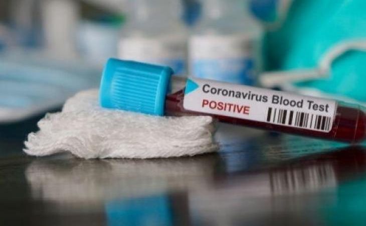 Bertambah Lagi 10, Total Positif Corona di Buol Jadi 19 Kasus
