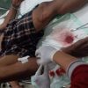 Polisi Tembak Pelaku Pencurian di Jalan Tombolotutu