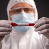 Upadte Corona RI 2 Mei: Positif 10.843 Kasus, Sembuh 1.665