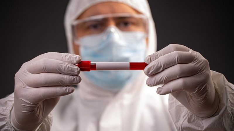 Upadte Corona RI 2 Mei: Positif 10.843 Kasus, Sembuh 1.665