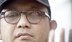Novel Baswedan Dilaporkan ke Dewas KPK
