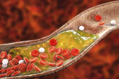 turunkan kolesterol tinggi