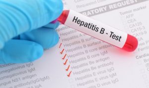 Upaya Pemerintah dan Langkah-Langkah Mencegah Hepatitis Akut