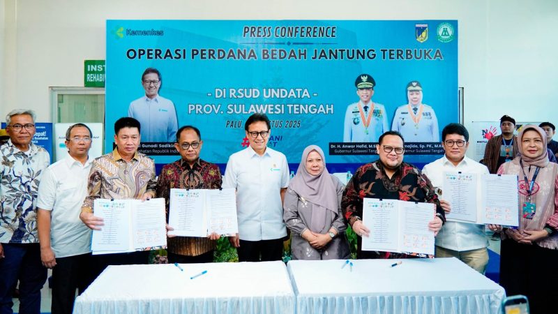 Sulteng Resmi Miliki Layanan Bedah Jantung Terbuka
