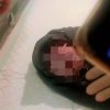 Bayi Lahir Tanpa Hidung di Wawonii Hebohkan Warga